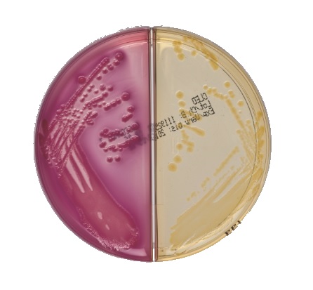 C.L.E.D.-/ MacConcey-Nährboden Nr. 3 Kombiplatte, 10 Stück C.L.E.D.-/ MacConcey-Nährboden Nr. 3 Kombiplatte, 10 Stück