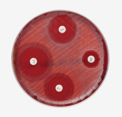 Müller-Hinton mit Blut 10 Platten Müller-Hinton mit Blut 10 Platten