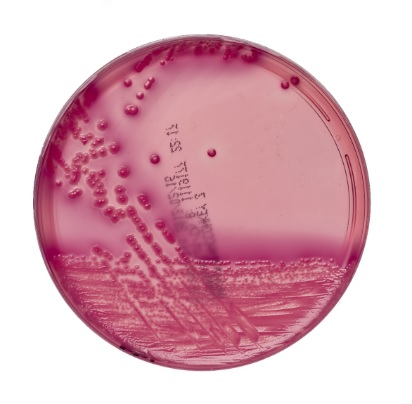 MacConkey Nährboden Nr. 3 10 Platten MacConkey Nährboden Nr. 3 10 Platten