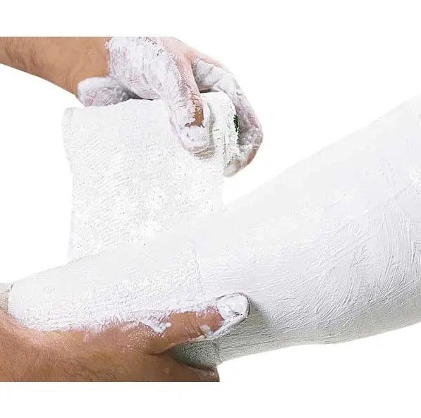 Weißgips