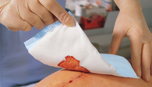 Zetuvit 10 x 20cm, 30 Stück unsterile Saugkompressen Zetuvit 10 x 20cm, 30 Stück unsterile Saugkompressen