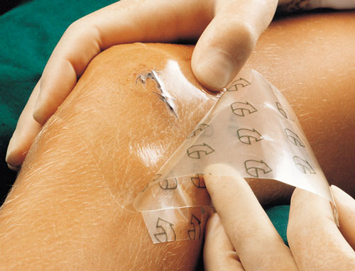 Suprasorb H 10 x 10cm, 10 St. Hydrokolloid-Verband, dünn Suprasorb H 10 x 10cm, 10 St. Hydrokolloid-Verband, dünn