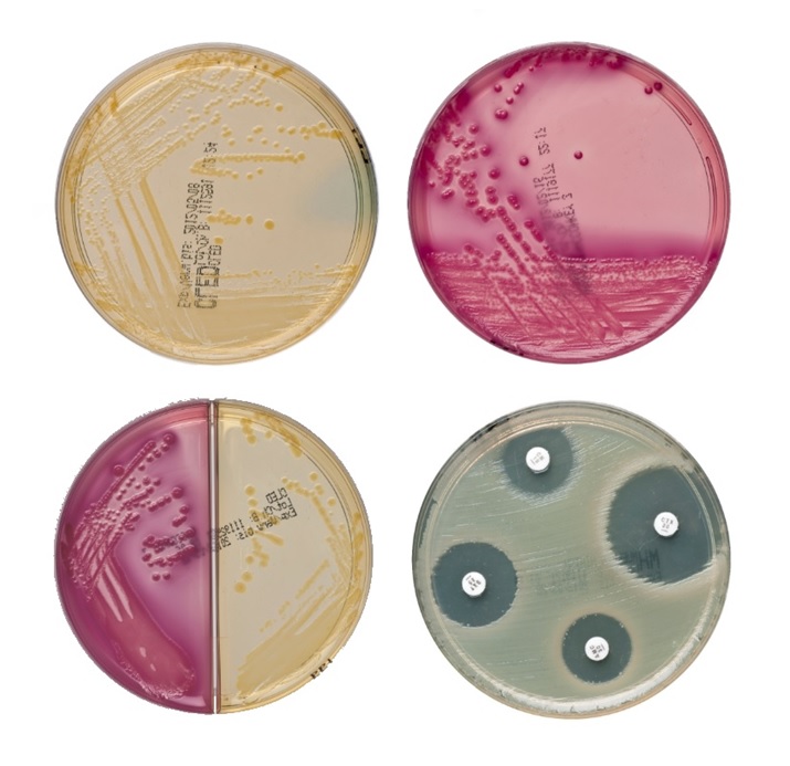 Sabouraud-Glucose Nährboden 10 Platten Sabouraud-Glucose Nährboden 10 Platten