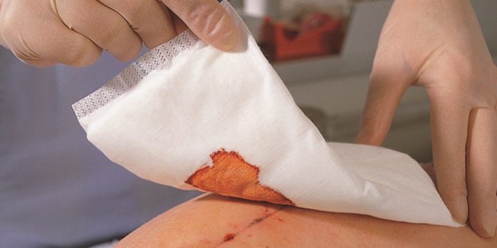 Zetuvit 10 x 10cm, 30 Stück unsterile Saugkompressen Zetuvit 10 x 10cm, 30 Stück unsterile Saugkompressen