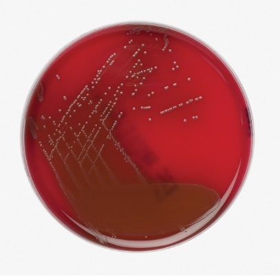 Aesculin-Blutagar, Mod. 10 Platten