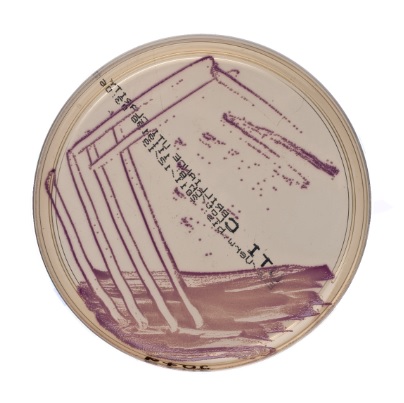 Brilliance (TM) Uti Clarity (TM) 10 Platten Brilliance (TM) Uti Clarity (TM) 10 Platten