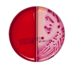 Columbia-CNA-Äsculin-Selektiv-Agar/ MacConcey-Nährboden Nr. 3 Kombiplatte, 10 Stück Columbia-CNA-Äsculin-Selektiv-Agar/ MacConcey-Nährboden Nr. 3 Kombiplatte, 10 Stück
