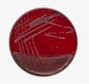 Columbia-Agar mit Schafblut plus 10 Platten
