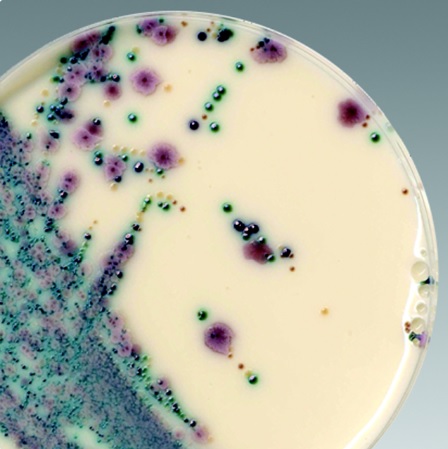 Biggy Agar (Candida n. Nickerson) 10 Platten